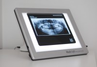 radiografii dentare digitale