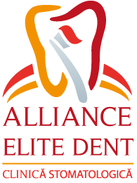 Alliance Elite Dent