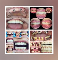 Dental Vocation Studio Dental Vocation Studio