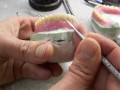 De ce proteza dentara aluneca?