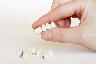 Ablatia restaurarilor dentare fixe