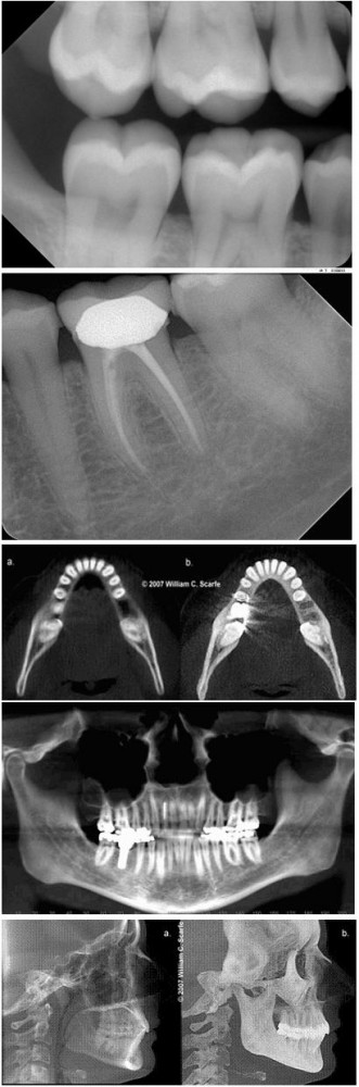 Radiografie dentara