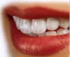 Dentis - Dr. Șerbu Vlad Dentis - Dr. Șerbu Vlad