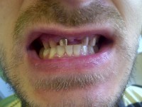 CMI Iorgulescu Adelina - Cazuri clinice rezolvate CMI Iorgulescu Adelina - Cazuri clinice rezolvate