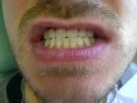 CMI Iorgulescu Adelina - Cazuri clinice rezolvate CMI Iorgulescu Adelina - Cazuri clinice rezolvate