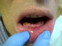 CMI Iorgulescu Adelina - Cazuri clinice rezolvate CMI Iorgulescu Adelina - Cazuri clinice rezolvate