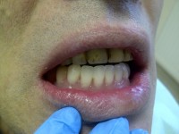 CMI Iorgulescu Adelina - Cazuri clinice rezolvate CMI Iorgulescu Adelina - Cazuri clinice rezolvate