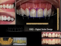 fatete ceramice   fatete ceramice