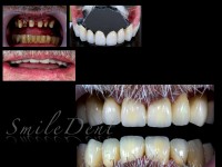 scheletata galvano scheletata galvano