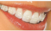 Jescala Art Dent - Dental Clinic