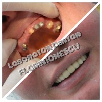 Laborator Dentar Florin Ionescu Laborator Dentar Florin Ionescu