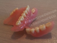 Proteze acrilice  Proteze acrilice