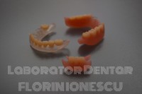 Proteze acrilice  Proteze acrilice