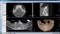 CT MANDIBULAR CT MANDIBULAR
