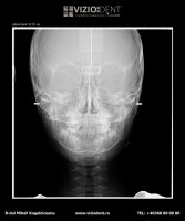 VizioDent - xray diagnostic imaging services by DentalAlex