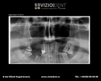 VizioDent - xray diagnostic imaging services by DentalAlex VizioDent - xray diagnostic imaging services by DentalAlex