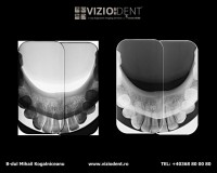VizioDent - xray diagnostic imaging services by DentalAlex VizioDent - xray diagnostic imaging services by DentalAlex
