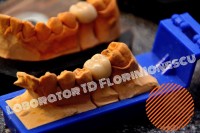 Metalo Ceramica - ivoclar inline