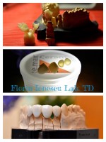 Ceramica presata e.max press Ceramica presata e.max press