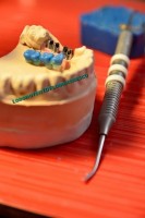 Laborator Dentar Florin Ionescu Laborator Dentar Florin Ionescu