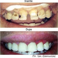 Dr. Gamureac Ion Dr. Gamureac Ion
