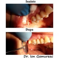 Dr. Gamureac Ion Dr. Gamureac Ion