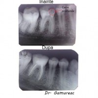 Dr. Gamureac Ion Dr. Gamureac Ion