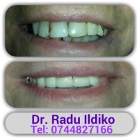 Cabinet stomatologic Dr. Radu Ildiko Cabinet stomatologic Dr. Radu Ildiko