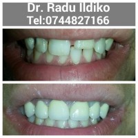 Cabinet stomatologic Dr. Radu Ildiko Cabinet stomatologic Dr. Radu Ildiko
