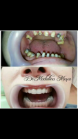 Dr. Madalina Mesca - Stomatologie Moderna Adulti si Copii Dr. Madalina Mesca - Stomatologie Moderna Adulti si Copii