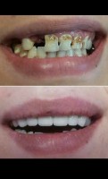 Dr. Madalina Mesca - Stomatologie Moderna Adulti si Copii Dr. Madalina Mesca - Stomatologie Moderna Adulti si Copii