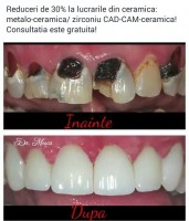 Dr. Madalina Mesca - Stomatologie Moderna Adulti si Copii Dr. Madalina Mesca - Stomatologie Moderna Adulti si Copii