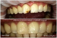 Dentaline Dentaline