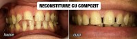 Dentaline Dentaline