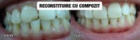 Dentaline Dentaline