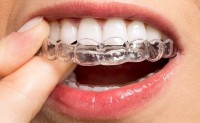 Religner - gutiere ortodontice invizibile
