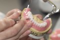 Din ce este realizata o proteza dentara?