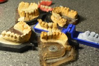 Laborator Dentar Florin Ionescu Laborator Dentar Florin Ionescu