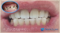 Denta Clinic Denta Clinic