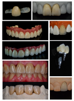 Wau Dental Studio - laborator tehnica dentara