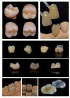 Wau Dental Studio - laborator tehnica dentara Wau Dental Studio - laborator tehnica dentara