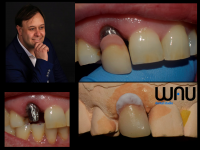 Wau Dental Studio - laborator tehnica dentara Wau Dental Studio - laborator tehnica dentara