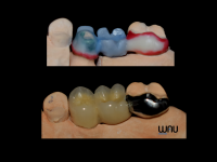 Wau Dental Studio - laborator tehnica dentara Wau Dental Studio - laborator tehnica dentara