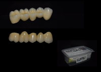 Wau Dental Studio - laborator tehnica dentara