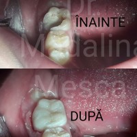 Dr. Madalina Mesca - Stomatologie Moderna Adulti si Copii Dr. Madalina Mesca - Stomatologie Moderna Adulti si Copii