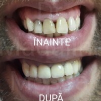 Dr. Madalina Mesca - Stomatologie Moderna Adulti si Copii Dr. Madalina Mesca - Stomatologie Moderna Adulti si Copii