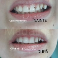Dr. Madalina Mesca - Stomatologie Moderna Adulti si Copii Dr. Madalina Mesca - Stomatologie Moderna Adulti si Copii