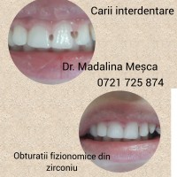 Dr. Madalina Mesca - Stomatologie Moderna Adulti si Copii Dr. Madalina Mesca - Stomatologie Moderna Adulti si Copii