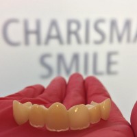 Lucrarare ceramica pe suport de zirconiu Lucrarare ceramica pe suport de zirconiu