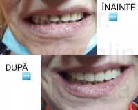 Dr. Madalina Mesca - Stomatologie Moderna Adulti si Copii Dr. Madalina Mesca - Stomatologie Moderna Adulti si Copii